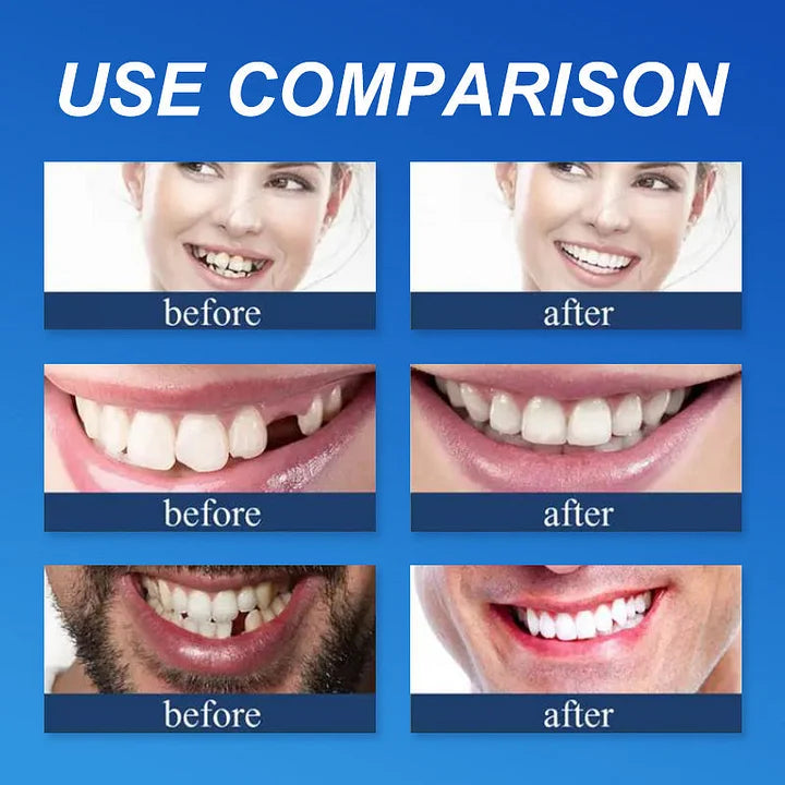 --Ends Today: 75% OFF! ⏰DarkFairy™ Medical Full Denture with Strong Suctiond Custom-Fit Full Functional Dentures🦷