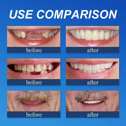 DarkFairy™ Medical Full Denture with Strong Suctiond Custom-Fit Full Functional Dentures🦷